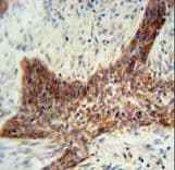 Polyclonal Rabbit anti-Human RILPL2 Antibody (aa120-149, IHC, WB)