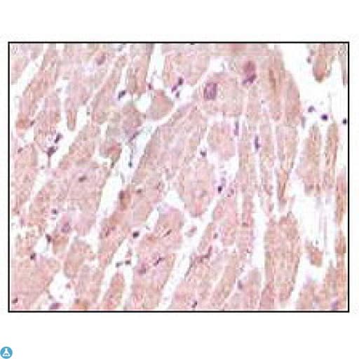 TNNI3 / Cardiac Troponin I Antibody