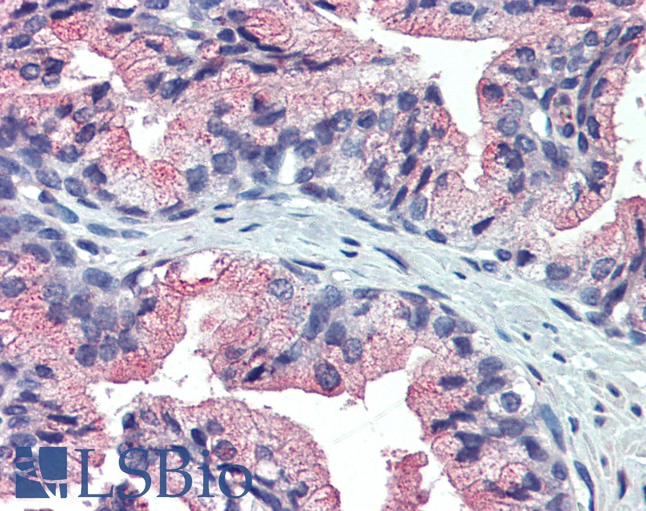 IHC-plus™ TM9SF3 Antibody (Internal)