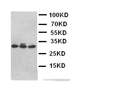 DKK1 Antibody (aa68-83)