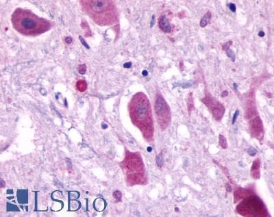 PathPlus™ Polyclonal Rabbit anti-Human CXCR4 Antibody (N-Terminus, IHC)