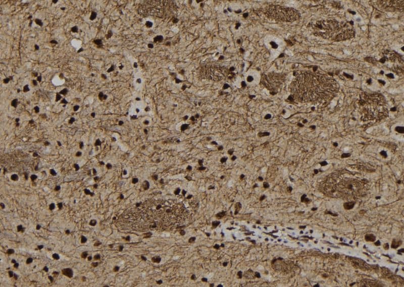 SNRPB2 Antibody