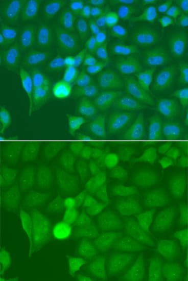 Polyclonal Rabbit anti-Human IRAK2 / IRAK-2 Antibody (IF, WB)