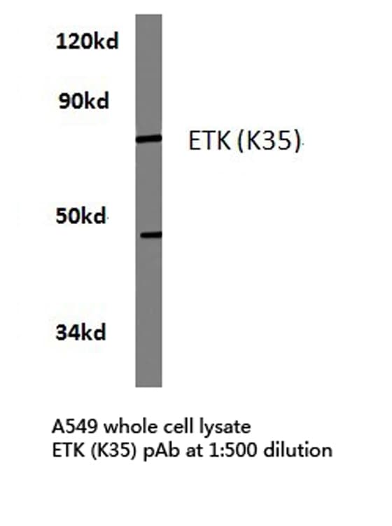 ETK / BMX Antibody (Lys35)