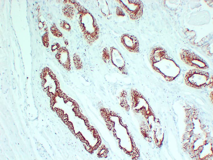 Monoclonal Mouse anti-Human AMACR / P504S Antibody (clone ABT-AMACR, IHC, WB)