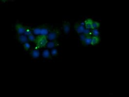 KLK8 / Kallikrein 8 Antibody (clone OTI9H7)