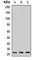 RAB7A / RAB7 Antibody
