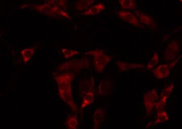 Polyclonal Rabbit anti-Human CNGB1 Antibody (IF, WB)