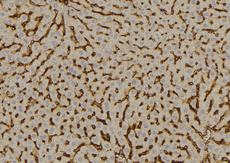 SULT2A1 / Sulfotransferase 2A1 Antibody