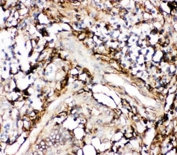 ANXA5 / Annexin V Antibody (aa2-320)