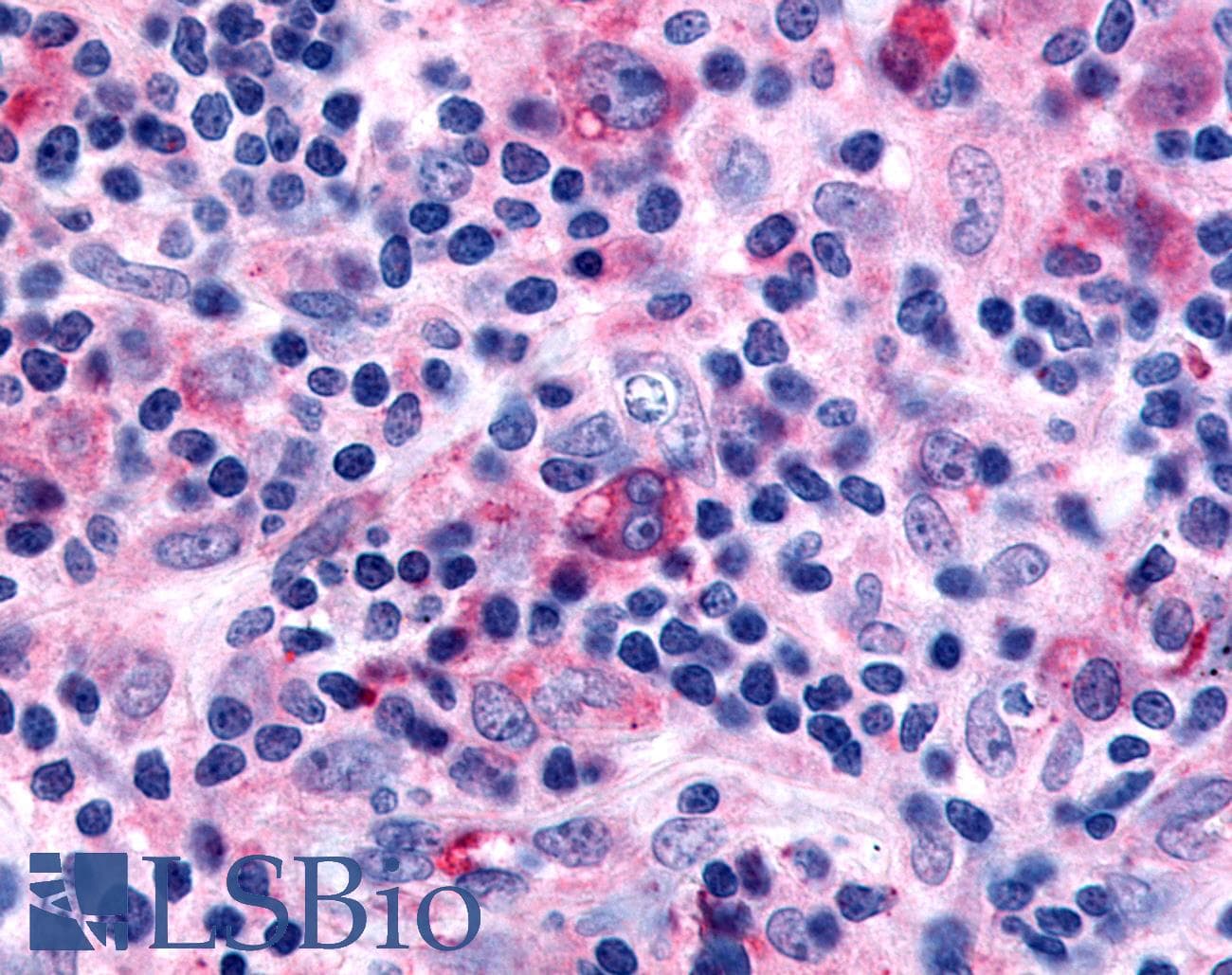PathPlus™ FFAR2 / GPR43 Antibody (Extracellular Domain)