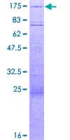 Human HIRA Protein (Recombinant GST)