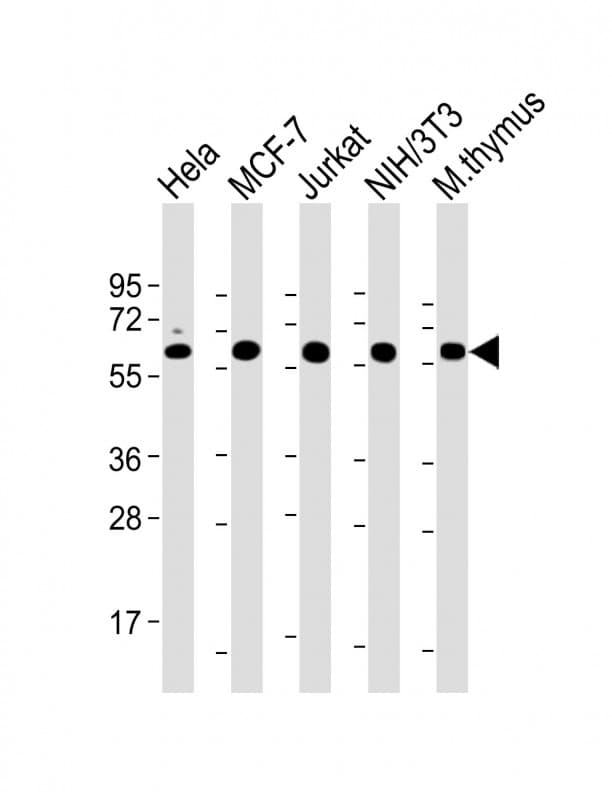 HSPD1 / HSP60 Antibody