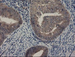 COMMD1 Antibody (clone OTI1G7)