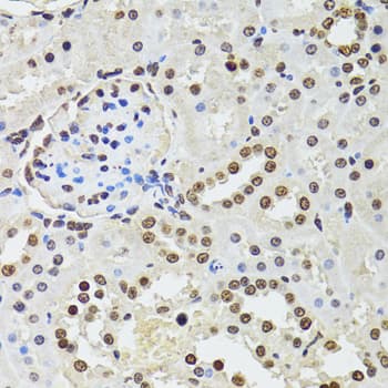 CDX2 Antibody