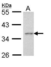 Polyclonal Rabbit anti-Human AEN Antibody (aa236-325, IHC, WB)