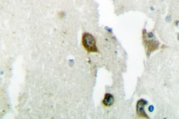 YWHAQ / 14-3-3 Theta Antibody (Gln67)