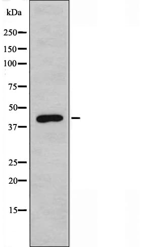 Polyclonal Rabbit anti-Human HTR6 / 5-HT6 Receptor Antibody (IF, WB)