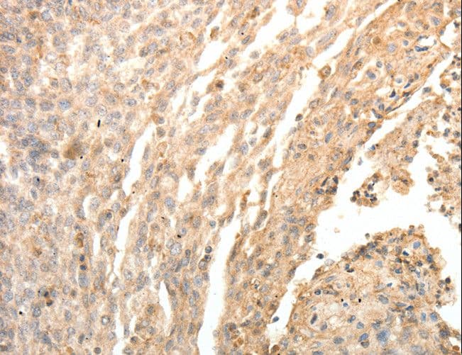 Polyclonal Rabbit anti-Human SFTPD / Surfactant Protein D Antibody (IHC)