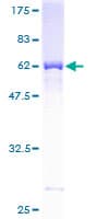 Human M-PST / STM Protein (Recombinant GST)