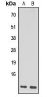 Polyclonal Rabbit anti-Human NDUFA1 Antibody (N-Terminus, WB)