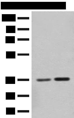 Polyclonal Rabbit anti-Human SLC25A27 / UCP4 Antibody (IHC, WB)