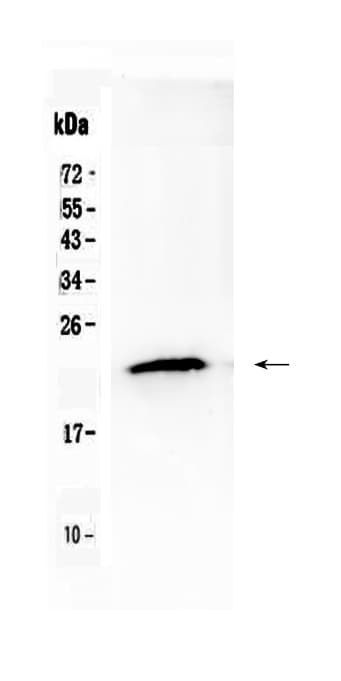 Polyclonal Rabbit anti-Human TMEM107 Antibody (IHC, WB)