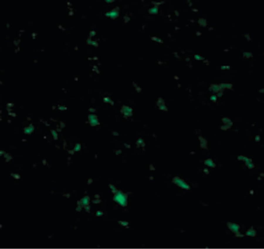 IHC-plus™ Polyclonal Rabbit anti-Human RNF216 / TRIAD3 Antibody (IHC, IF, WB)
