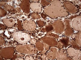 Monoclonal Mouse anti-Human GAPDH Antibody (clone OTI2F9, IHC, WB)