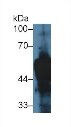 KRT14 / CK14 / Cytokeratin 14 Antibody (aa122-429)
