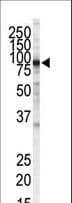 Monoclonal Mouse anti-Human IKBKB / IKK2 / IKK Beta Antibody (clone 62AT216, WB)