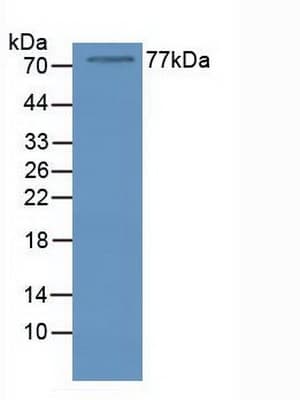 NCL / Nucleolin Antibody (aa388-569)