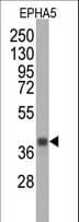 EPHA5 / EPH Receptor A5 Antibody (clone 46CT61.6.4)