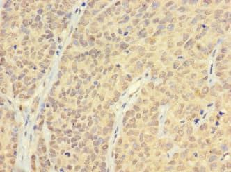 Polyclonal Rabbit anti-Human AR / Androgen Receptor Antibody (IHC)