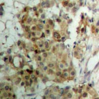 PR / Progesterone Receptor Antibody (phospho-Ser190)