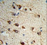 Polyclonal Rabbit anti-Human FMOD / Fibromodulin Antibody (aa337-364, IHC, WB)
