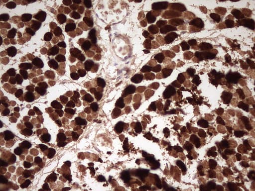 Monoclonal Mouse anti-Human TNNI2 Antibody (clone OTI3A11, Carrier-free, IHC, WB)