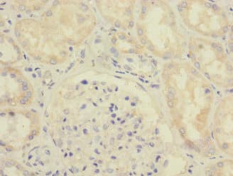 SAV1 / WW45 Antibody