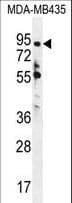 ZNF605 Antibody (aa48-77)