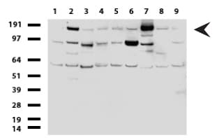 ERBB2 / HER2 Antibody (aa676-1255, clone UMAB35, Carrier-free)