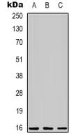 Polyclonal Rabbit anti-Human CEBPG / CEBP Gamma Antibody (Internal, IHC, IF, WB)