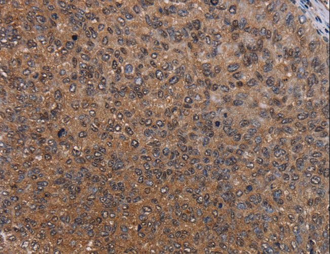 Polyclonal Rabbit anti-Human HYAL2 Antibody (IHC)