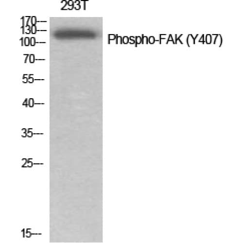 FAK / Focal Adhesion Kinase Antibody (350-430 aa)