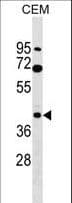 CACNG3 Antibody (aa28-56)