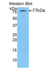 AGT / Angiotensinogen Antibody (aa35-485)
