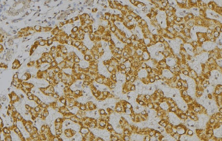 GAS2 Antibody
