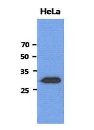 Monoclonal Mouse anti-Human SBDS Antibody (clone AT1E8, WB)