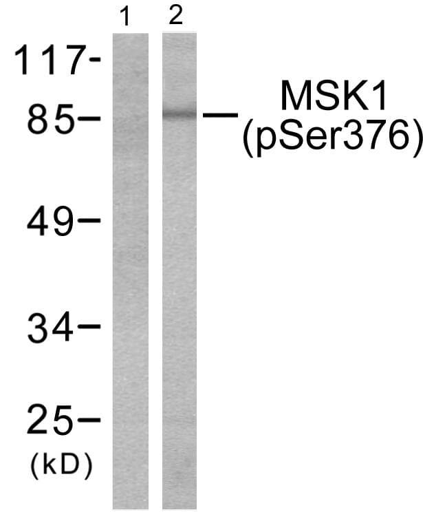 RPS6KA5 / MSK1 Antibody (phospho-Ser376)