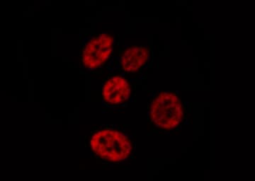 PTPN6 / SHP1 Antibody