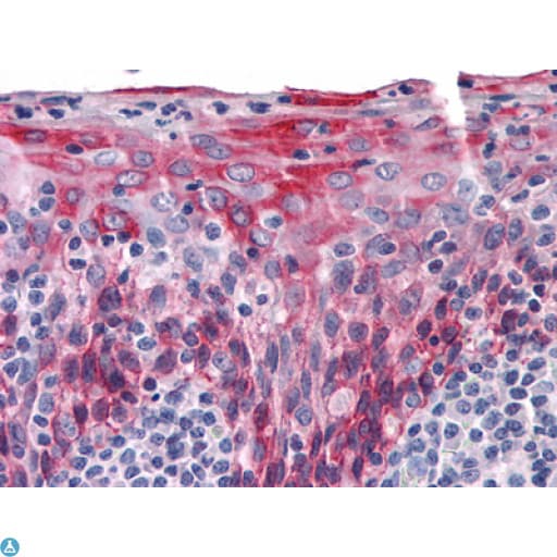 KRT15 / CK15 / Cytokeratin 15 Antibody